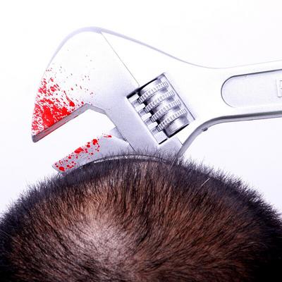 Kafaya Saplanmış İngiliz Anahtarı Şaka Tacı